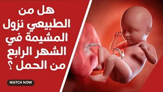 هل من الطبيعي نزول المشيمة في الشهر الرابع من الحمل ؟