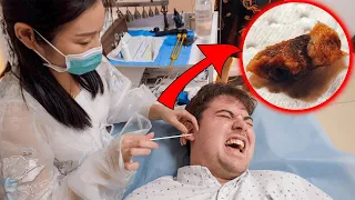Probando la extracción china de la cera de oídos (ESTO ES LO QUE SALIÓ)
