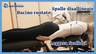 Risolvere Sindromi Posturali con la Chiropratica