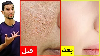 اسرع طريقة للتخلص من المسام الواسعة والبشرة الدهنية
