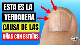 🔴 ¿Porque tengo UÑAS con ESTRÍAS? ¡Esta es la verdadera CAUSA! Tu cuerpo te HABLA