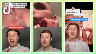 The Most Satisfying TikTok Cyst Popping Reactions Compilation!