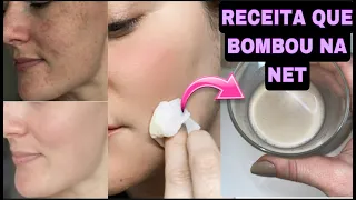 ESSE VÍDEO TEVE MAIS DE 5 MILHÕES DE VISUALIZAÇÕES/ ADEUS MELASMA, RUGAS E MANCHAS NA PELE