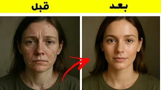 5 أطعمة تعيد النضارة لبشرتك | دقيقتان ستجعلك شخصاً آخر ..مع قناة صحة بدون تعقيد