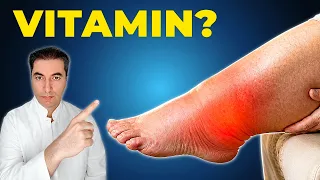 Otečene noge nakon 50? Nedostaje Vam ovaj VITAMIN!