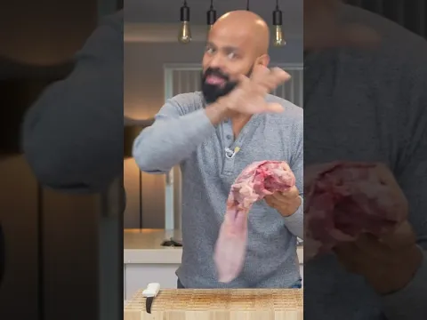 ഫുഡിൽ നിന്ന് വിര കണ്ണിൽ കേറി/ TAPEWORM/TOXOPLASMOSIS/FOODBORNE ILLNESS/INFECTED VEGETABLE/WATER/MEAT