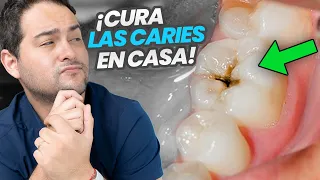 LA VERDAD SOBRE LA CARIES DENTAL ¿Como curarla en casa?