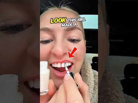 She Used Nail Polish on Her Teeth… And Instantly Regretted It 😂🦷💅
