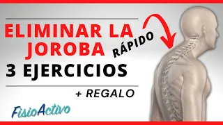 Cómo ELIMINAR la JOROBA de la Espalda 🐫[ 3 EJERCICIOS FÁCILES ] + REGALO! 🎁