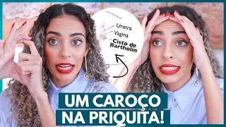 CISTO DE BARTHOLIN E MARSUPIALIZAÇÃO: Toda minha experiência REAL com caroço LÁ