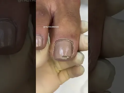 Professional pedicure talitacardozo