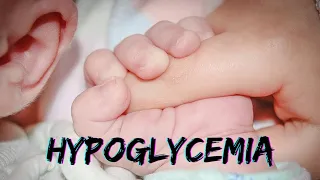 Conditions Associated with Hypoglycemia in the Newborn Many different conditions are associated.