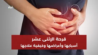 قرحة الإثنى عشر، أسبابها وأعراضها وكيفية الوقاية منها والعلاج...  د. ياسر أبو صفية