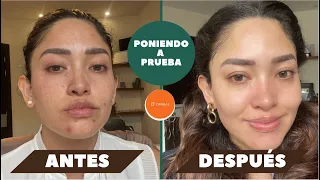 Poniendo a prueba sueros de Yanbal | Mich