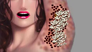 ASMR Armpit Dog Ticks Removal Animation