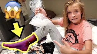 BROKEN FOOT from WILD PITCH at SOFTBALL GAME! 🥎