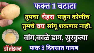फक्त 1 बटाटा, चेहऱ्यावरील वांग काळे डाग सुरकुत्या 3 दिवसात कमी, vang chehra gora Dr. todkar upchar