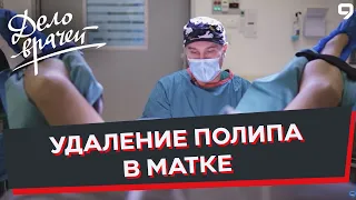 Программа "Дело врачей". Полипэктомия матки. Полип в матке. Внутриматочная операция.