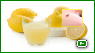 Treatment for bed bug bites | Get Rid of Bed Bug Bites | how to get rid of bed bug bites overnight