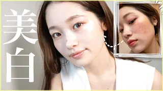 美白命！ニキビ毛穴ゼロ！私が実際に変われたスキンケア【乾燥肌】