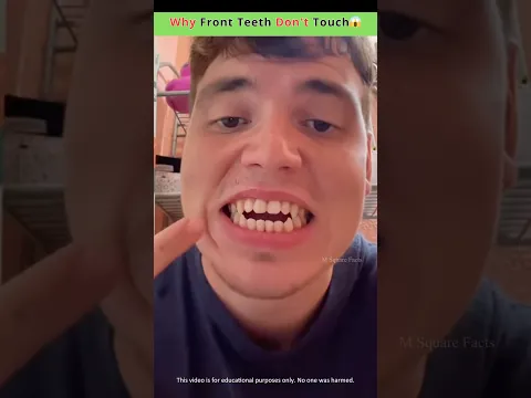 Why Front Teeth Don’t Touch😱
