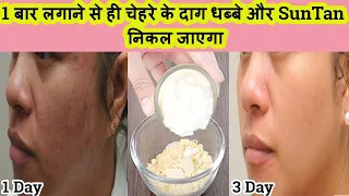 1 Days Challenge   Skin Brightening at Home Visible Spotless Glowing Skin After 1 Uses