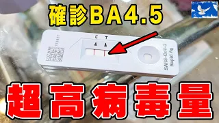 確診了...終究還是逃不過。BA5症狀有多可怕? | 蒼藍鴿聊醫學EP238