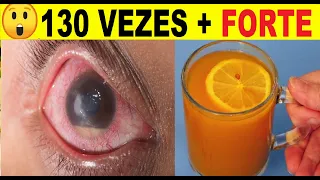 MATA A CATARATA E GLAUCOMA | RECUPERA 98% DA VISÃO| 130 VEZES + FORTE QUE OCULOS.