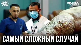 ВСЯ НОГА ГНИЕТ | ИСТОРИЯ КОТОРАЯ ТРОНУЛА ВСЕХ | АЙТЫМ ПОМОГИ МНЕ 