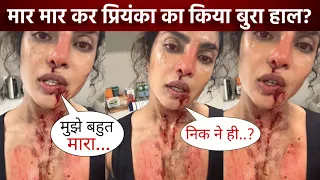 Priyanka Chopra को ये क्या हो गया? किसने किया Bollywood actress का ये हाल