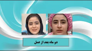 دو ماه بعد از عمل بینی