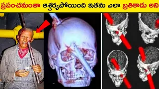 😳 ప్రపంచమంతా ఆశ్చర్యపోయింది ఇతను ఎలా బ్రతికాడు అని|TOP 15 INTRESTING FACTS IN TELUGU|FACTS AGENT