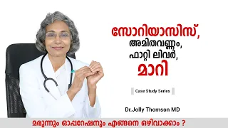 CS05/2425 സോറിയാസിസ്,അമിതവണ്ണം,ഫാറ്റി ലിവർ മാറി-18yr F Psoriasis,Fatty Liver,Obesity,Reversed