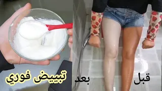 والله ثم والله أقوى وصفة لتبييض الوجه والجسم من التصبغات والبقع جربتها صدمتني بروعتهافي تبيض البشرة👌