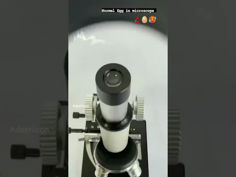 egg 🥚 In Microscope 🔬😱#shorts