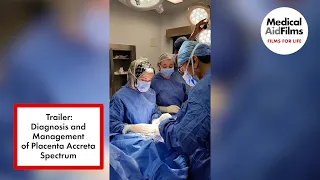 Placenta Accreta Trailer