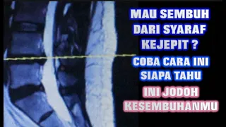 PENYEMBUHAN ALAMIAH SYARAF KEJEPIT / PENGOBATAN HNP L4 - L5
