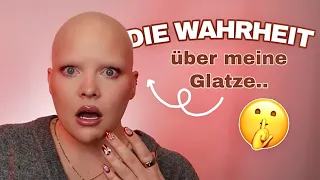 Glatze?! - das ist der Grund für meine Krankheit 😱👩🏼‍🦲