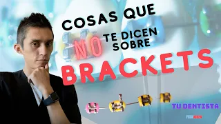 mitos y verdades sobre los brackets
