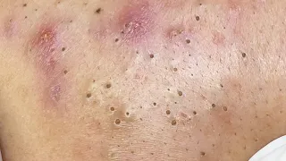 Satisfying Relaxing with Sac Dep Spa #446