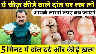 एक बार में दांत का कीड़ा और दर्द बाहर निकालने का बेहतरीन उपाय - How To Get Rid Of Tooth Cavity