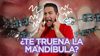 😖 ”ME TRUENA LA MANDÍBULA” 😖 ¡DEBERÍAS VER ESTE VIDEO!😍 (🔥CASO de CHASQUIDOS RESUELTO🔥)