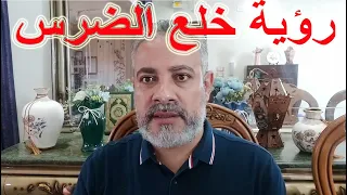تفسير رؤية خلع الضرس في المنام | اسماعيل الجعبيري