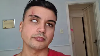 perdi o olho mas ganhei 1 milhão