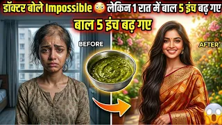 डॉक्टर बोले Impossible 😳 लेकिन 1 रात में बाल 5 इंच बढ़ गए!