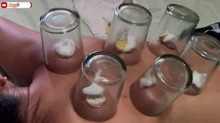 DIY: HOW TO DO VENTOSA AT HOME #ventosa #cuppingtherapy #cupping