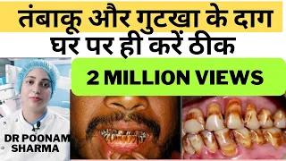 दांतों से तंबाकू और गुटखा के दाग घर पर ही करे साफ | Tambaku Gutkha Ke Daag Htane Ke Gharelu Upchar