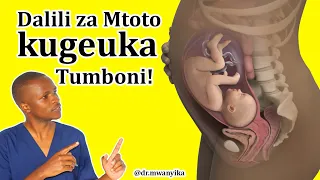 Je Dalili ZA Mtoto Kugeuka Tumboni Mwa Mjamzito NI Zipi? (Dalili 5 ZA Mtoto Kugeuka Ktk Ujauzito)!