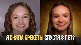 МОЯ ИСТОРИЯ С БРЕКЕТАМИ | ПОЧЕМУ 8 ЛЕТ?