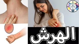 اسباب حكه الجسم خاصه ليلا وكيفيفه التخلص منها بأذن لله